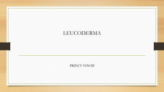 LEUCODERMA
PRINCY VINOD
 