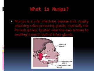 What is Mumps?
 Mumps is a viral infectious disease and, usually
attacking saliva producing glands, especially the
Parotid glands, located near the ears leading to
swelling in one or both of these glands.
 