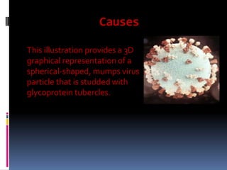 Causes
This illustration provides a 3D
graphical representation of a
spherical-shaped, mumps virus
particle that is studded with
glycoprotein tubercles.
 