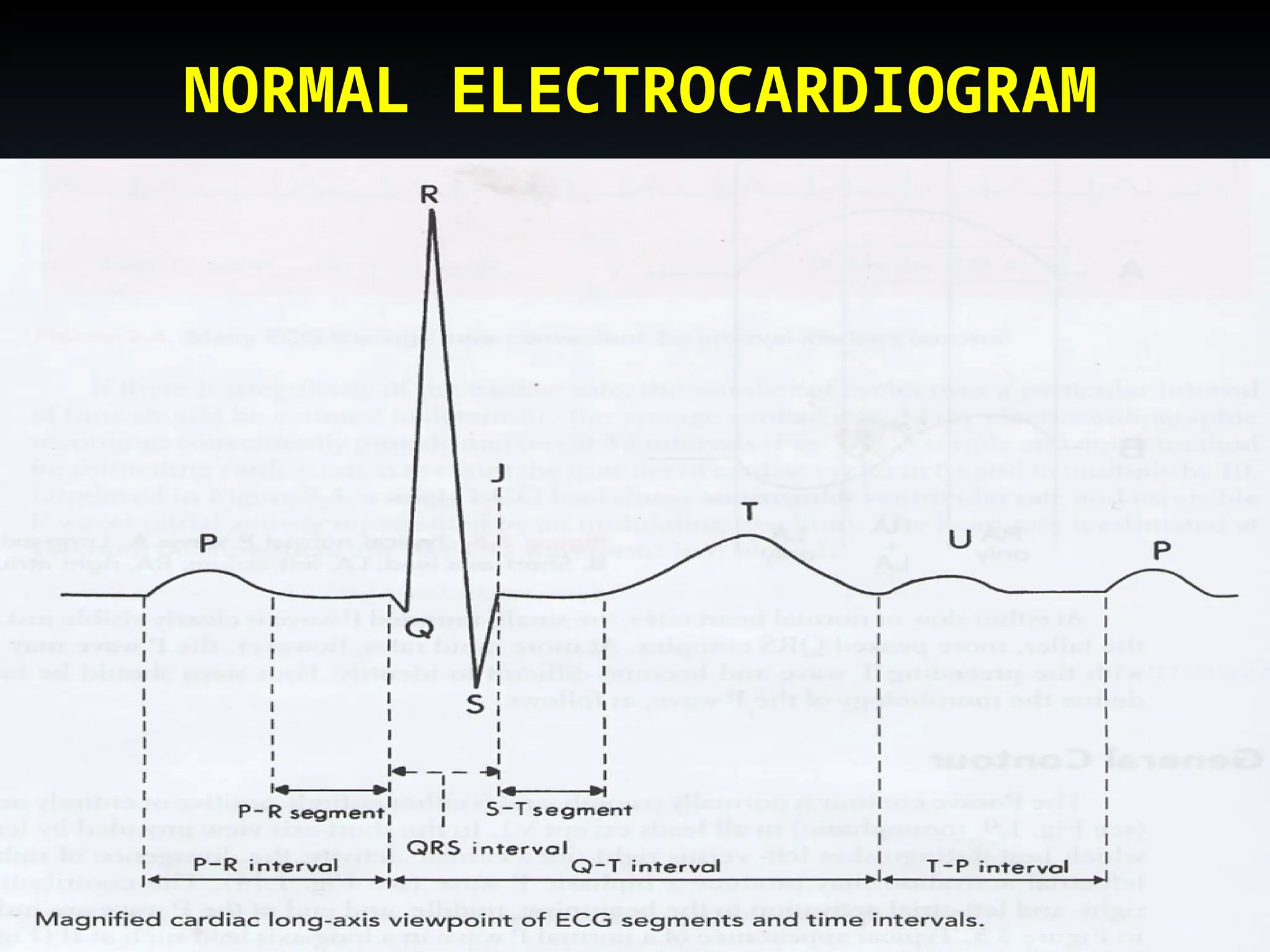 PPt on Normal ECG & P Wave with Normal ECG & P Wave.ppt