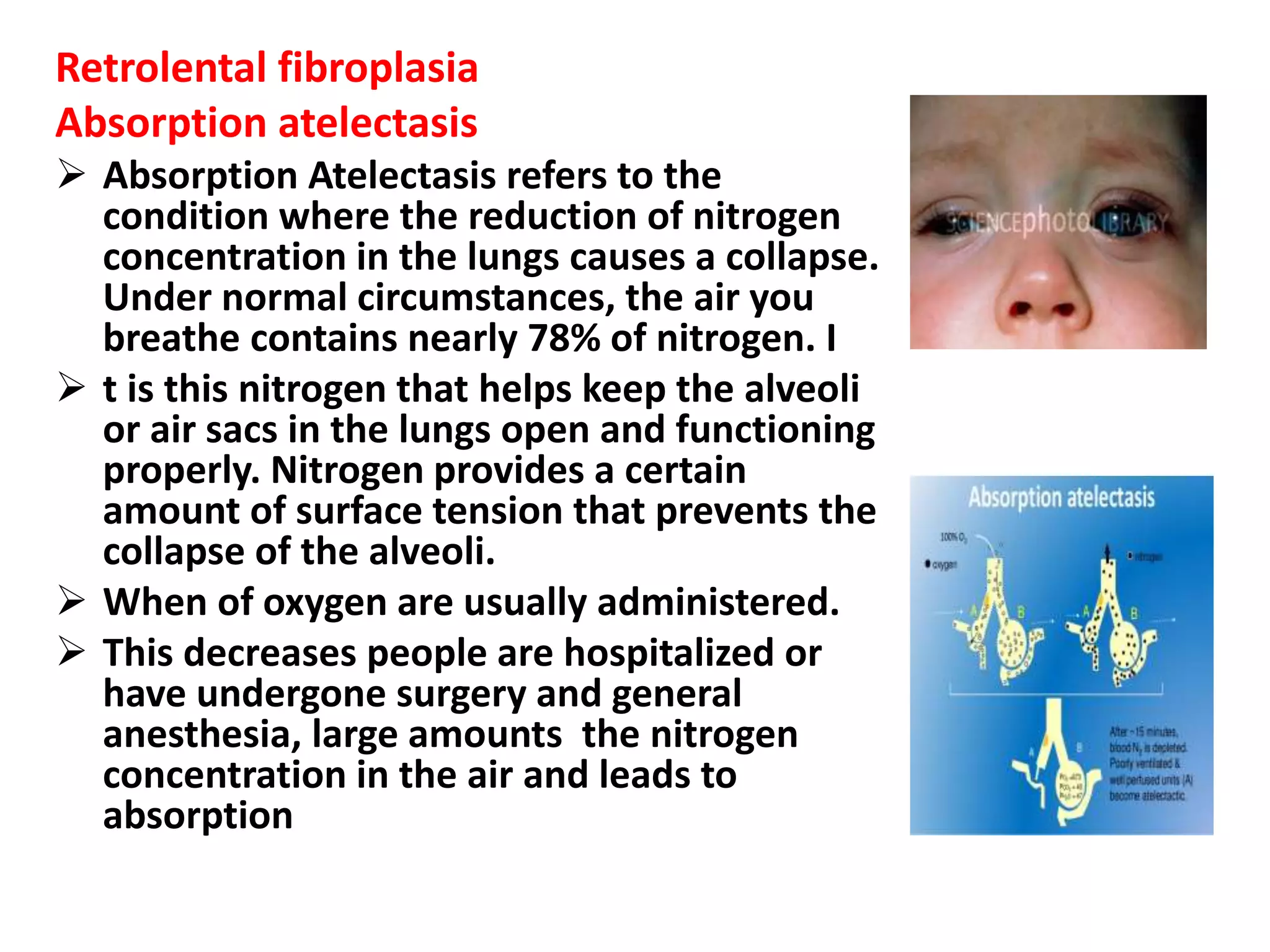 Retrolental fibroplasia
Absorption atelectasis
 Absorption Atelectasis refers to the
condition where the reduction of nitrogen
concentration in the lungs causes a collapse.
Under normal circumstances, the air you
breathe contains nearly 78% of nitrogen. I
 t is this nitrogen that helps keep the alveoli
or air sacs in the lungs open and functioning
properly. Nitrogen provides a certain
amount of surface tension that prevents the
collapse of the alveoli.
 When of oxygen are usually administered.
 This decreases people are hospitalized or
have undergone surgery and general
anesthesia, large amounts the nitrogen
concentration in the air and leads to
absorption
 
