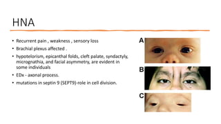 HNA
• Recurrent pain , weakness , sensory loss
• Brachial plexus affected .
• hypotelorism, epicanthal folds, cleft palate, syndactyly,
micrognathia, and facial asymmetry, are evident in
some individuals
• EDx - axonal process.
• mutations in septin 9 (SEPT9)-role in cell division.
 