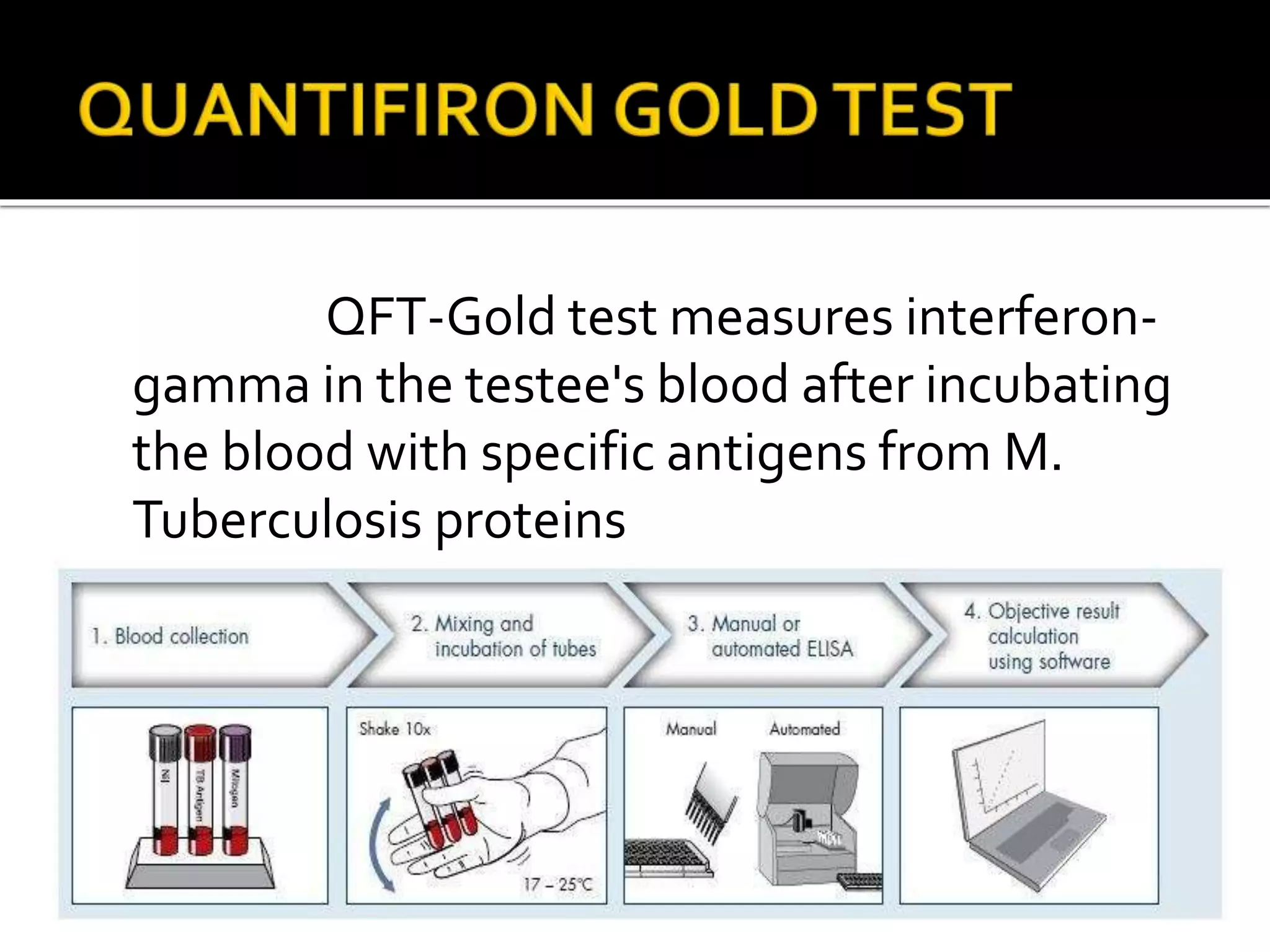Qft Test Seminar on Pulmonary Tuberculosis | PPTX