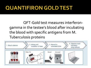 QFT-Gold test measures interferon-
gamma in the testee's blood after incubating
the blood with specific antigens from M.
Tuberculosis proteins
 