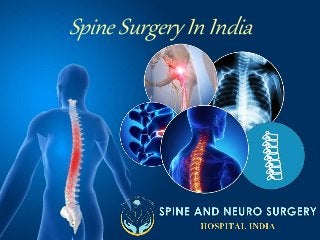Spine Surgery In India
 