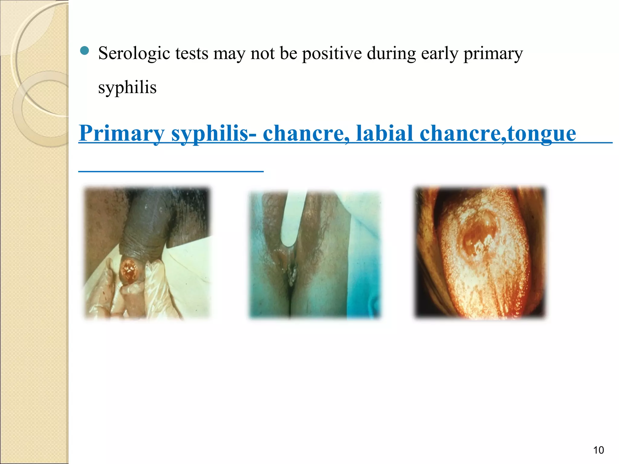 Syphilis | PPT | Infectious Diseases | Diseases and Conditions