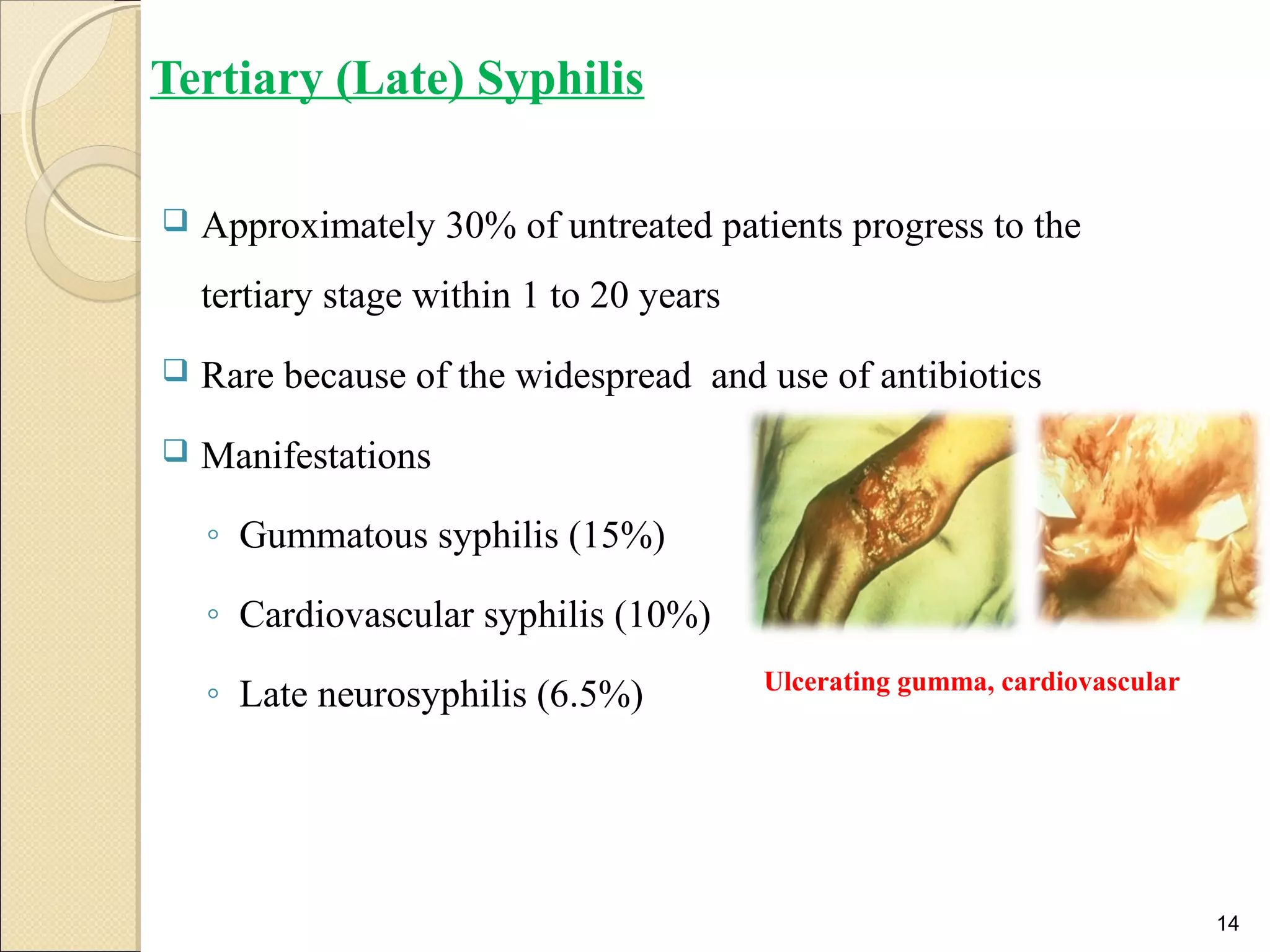 Tertiary (Late) Syphilis
 Approximately 30% of untreated patients progress to the
tertiary stage within 1 to 20 years
 Rare because of the widespread and use of antibiotics
 Manifestations
◦ Gummatous syphilis (15%)
◦ Cardiovascular syphilis (10%)
◦ Late neurosyphilis (6.5%)
14
Ulcerating gumma, cardiovascular
 