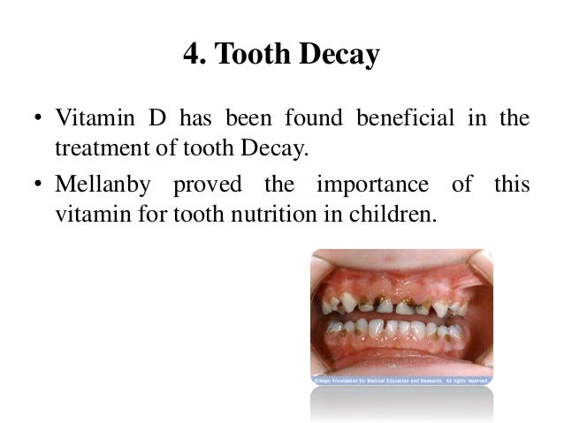 c requirement for vitamin daily adults dk krushna vitamin yadav Ppt on by D c requirement for vitamin daily adults dk krushna vitamin yadav Ppt on by D