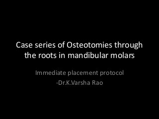 Case series of Osteotomies through
the roots in mandibular molars
Immediate placement protocol
-Dr.K.Varsha Rao
 