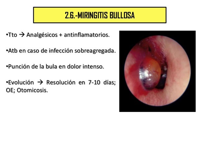 Otitis