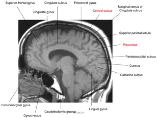 Marginal Ramus Ppt parietal lobe | PPT