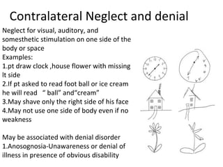 Ppt parietal lobe | PPT