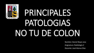 PRINCIPALES
PATOLOGIAS
NO TU DE COLON
Nombre: Daniel Reyes Jara
Asignatura: Radiología 2
Docente: José Alonso Díaz
 
