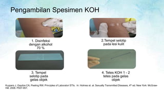 Peeling Principles PPT pemeriksaan lab sederhana.pptx