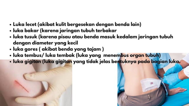 PPT PERAWATAN LUKA. IRA ANGGRIANI.pdf
