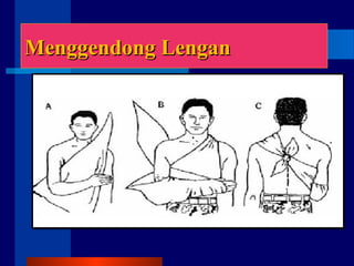 Menggendong LenganMenggendong Lengan
 