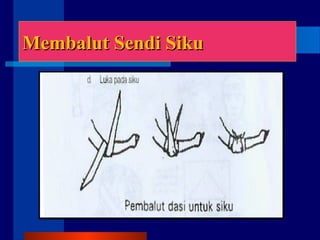 Membalut Sendi SikuMembalut Sendi Siku
 