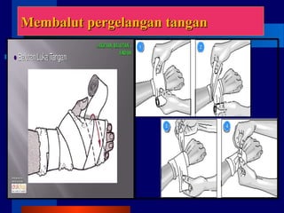 Membalut pergelangan tanganMembalut pergelangan tangan
 