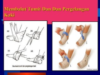 Membalut Tumit Dan Dan PergelanganMembalut Tumit Dan Dan Pergelangan
KakiKaki
 