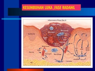 KESEMBUHAN LUKA ,FASE RADANG
 
