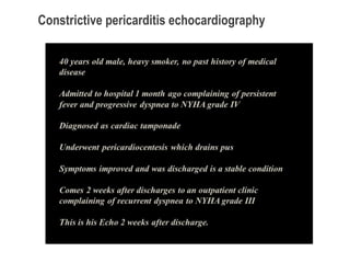 Constrictive pericarditis echocardiography
 