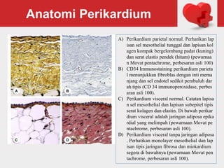 Anatomi Perikardium
A) Perikardium parietal normal. Perhatikan lap
isan sel mesothelial tunggal dan lapisan kol
agen kompak bergelombang padat (kuning)
dan serat elastis pendek (hitam) (pewarnaa
n Movat pentachrome, perbesaran asli 100)
B) CD34 Immunostaining perikardium parieta
l menunjukkan fibroblas dengan inti mema
njang dan sel endotel sedikit pembuluh dar
ah tipis (CD 34 immunoperoxidase, perbes
aran asli 100).
C) Perikardium visceral normal. Catatan lapisa
n sel mesothelial dan lapisan subepitel tipis
serat kolagen dan elastin. Di bawah perikar
dium visceral adalah jaringan adiposa epika
rdial yang melimpah (pewarnaan Movat pe
ntachrome, perbesaran asli 100).
D) Perikardium visceral tanpa jaringan adiposa
. Perhatikan monolayer mesothelial dan lap
isan tipis jaringan fibrosa dan miokardium
segera di bawahnya (pewarnaan Movat pen
tachrome, perbesaran asli 100).
 