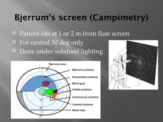 Bjerrum’s screen (Campimetry)
 Patient sits at 1 or 2 m from flate screen
 For central 30 deg only
 Done under subdued lighting
 