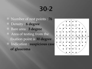 30-2
 Number of rest points : 76
 Density : 6 degree
 Bare area : 3 degree
 Area of testing from the
fixation point is 30 degree
 Indication : suspicious case
of glaucoma
 