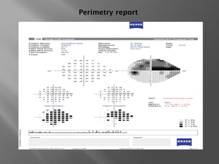Perimetry report
 