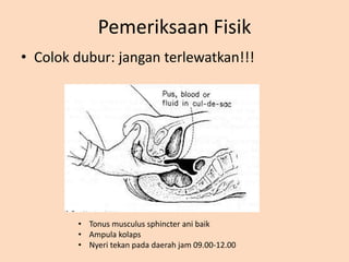 Pemeriksaan Fisik
• Colok dubur: jangan terlewatkan!!!
• Tonus musculus sphincter ani baik
• Ampula kolaps
• Nyeri tekan pada daerah jam 09.00-12.00
 