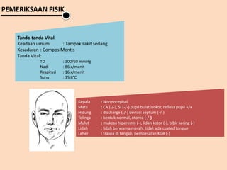 PEMERIKSAAN FISIK
Tanda-tanda Vital
Keadaan umum : Tampak sakit sedang
Kesadaran : Compos Mentis
Tanda Vital:
TD : 100/60 mmHg
Nadi : 86 x/menit
Respirasi : 16 x/menit
Suhu : 35,8°C
Kepala : Normocephal
Mata : CA (-/-), SI (-/-) pupil bulat isokor, refleks pupil +/+
Hidung : discharge (-/-) deviasi septum (-/-)
Telinga : bentuk normal, otorea (-/-)
Mulut : mukosa hiperemis (-), lidah kotor (-), bibir kering (-)
Lidah : lidah berwarna merah, tidak ada coated tongue
Leher : trakea di tengah, pembesaran KGB (-)
 