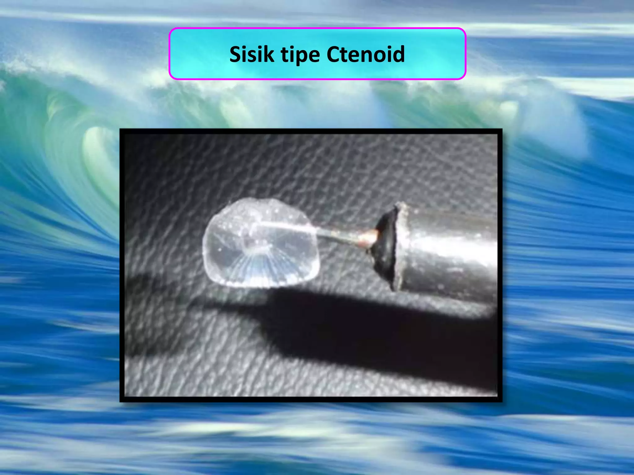 Sisik tipe Ctenoid
 