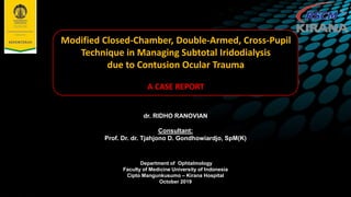 dr. RIDHO RANOVIAN
Consultant:
Prof. Dr. dr. Tjahjono D. Gondhowiardjo, SpM(K)
Department of Ophtalmology
Faculty of Medicine University of Indonesia
Cipto Mangunkusumo – Kirana Hospital
October 2019
Modified Closed-Chamber, Double-Armed, Cross-Pupil
Technique in Managing Subtotal Iridodialysis
due to Contusion Ocular Trauma
A CASE REPORT
 
