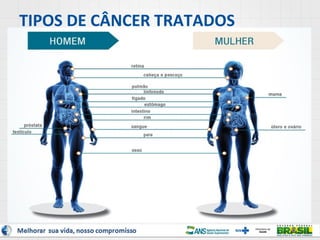 TIPOS DE CÂNCER TRATADOS

 