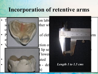 Comprehensive Guide to Pre-Surgical Naso-Alveolar Molding for Cleft Lip ...