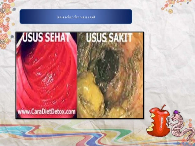 Ppt Pncernaan 2 55619159