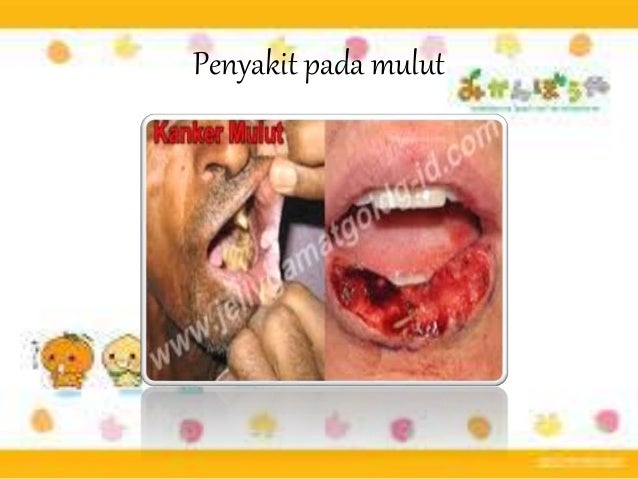 Ppt Pncernaan 2 55619159