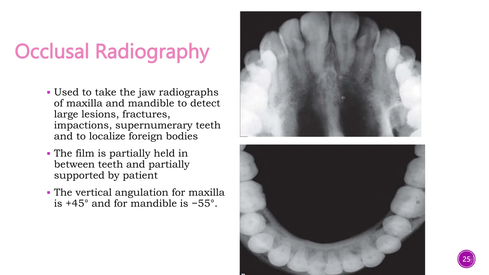 Radiographic Techniques in Pediatric Dentistry- part one , Essentials ...