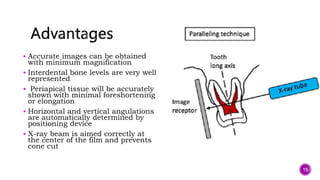  Accurate images can be obtained
with minimum magnification
 Interdental bone levels are very well
represented
 Periapical tissue will be accurately
shown with minimal foreshortening
or elongation
 Horizontal and vertical angulations
are automatically determined by
positioning device
 X-ray beam is aimed correctly at
the center of the film and prevents
cone cut
15
 
