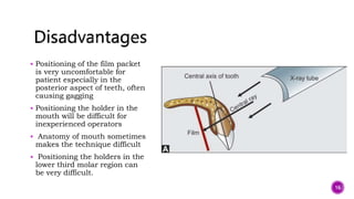  Positioning of the film packet
is very uncomfortable for
patient especially in the
posterior aspect of teeth, often
causing gagging
 Positioning the holder in the
mouth will be difficult for
inexperienced operators
 Anatomy of mouth sometimes
makes the technique difficult
 Positioning the holders in the
lower third molar region can
be very difficult.
16
 