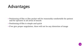  Positioning of film or film packet will be reasonably comfortable for patient
and for operator in all areas of mouth
 Positioning of film is simple and quick
 If we give proper angulation, there will not be any distortion of image
20
 