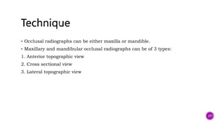  Occlusal radiographs can be either maxilla or mandible.
 Maxillary and mandibular occlusal radiographs can be of 3 types:
1. Anterior topographic view
2. Cross sectional view
3. Lateral topographic view
27
 