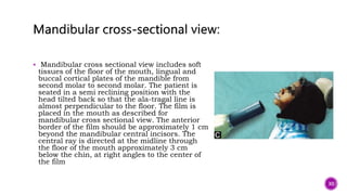  Mandibular cross sectional view includes soft
tissues of the floor of the mouth, lingual and
buccal cortical plates of the mandible from
second molar to second molar. The patient is
seated in a semi reclining position with the
head tilted back so that the ala-tragal line is
almost perpendicular to the floor. The film is
placed in the mouth as described for
mandibular cross sectional view. The anterior
border of the film should be approximately 1 cm
beyond the mandibular central incisors. The
central ray is directed at the midline through
the floor of the mouth approximately 3 cm
below the chin, at right angles to the center of
the film
30
 