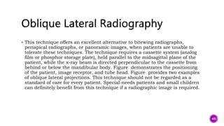  This technique offers an excellent alternative to bitewing radiographs,
periapical radiographs, or panoramic images, when patients are unable to
tolerate these techniques. The technique requires a cassette system (analog
film or phosphor storage plate), held parallel to the midsagittal plane of the
patient, while the x-ray beam is directed perpendicular to the cassette from
behind or below the mandibular body. Figure demonstrates the positioning
of the patient, image receptor, and tube head. Figure provides two examples
of oblique lateral projections. This technique should not be regarded as a
standard of care for every patient. Special-needs patients and small children
can definitely benefit from this technique if a radiographic image is required.
49
 