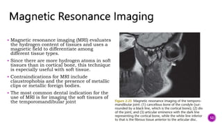  Magnetic resonance imaging (MRI) evaluates
the hydrogen content of tissues and uses a
magnetic field to differentiate among
different tissue types.
 Since there are more hydrogen atoms in soft
tissues than in cortical bone, this technique
is especially useful with soft tissue.
 Contraindications for MRI include
claustrophobia and the presence of metallic
clips or metallic foreign bodies.
 The most common dental indication for the
use of MRI is for imaging the soft tissues of
the temporomandibular joint
52
 