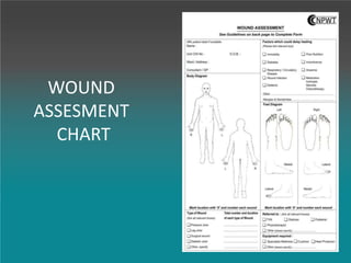 WOUND
ASSESMENT
CHART
 