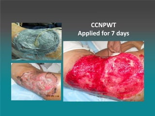 CCNPWT
Applied for 7 days
 