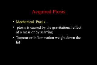 Acquired Ptosis
• Mechanical Ptosis –
• ptosis is caused by the gravitational effect
of a mass or by scarring
• Tumour or inflammation weight down the
lid
 