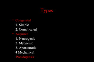 Typess
• Congenital
1. Simple
2. Complicated
• Acquired
1. Neurogenic
2. Myogenic
3. Aponeurotic
4 Mechanical
Pseudoptosis
 