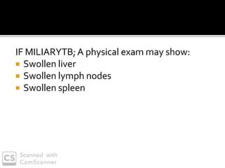 PULMONARY TUBERCULOSIS